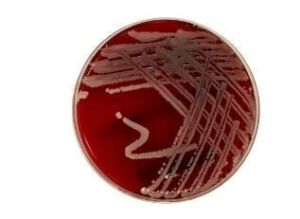 DESCRIPTION: (10) PACKS OF (10) BLOOD AGAR BRAND/MODEL: REMEL #696674 INFORMATION: SHEEPS BLOOD RETAIL$: $49.99 TOTAL QTY: 10